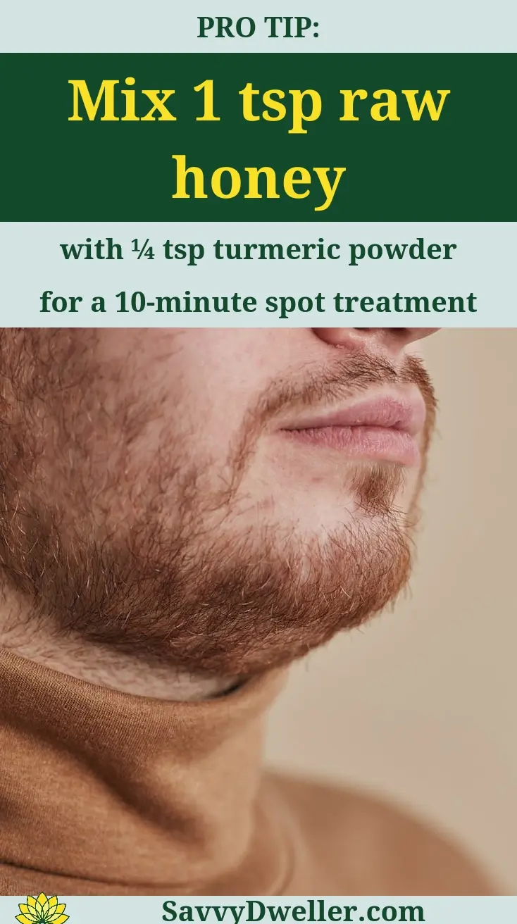 Raw honey and turmeric mixture for hormonal acne treatment along the jawline