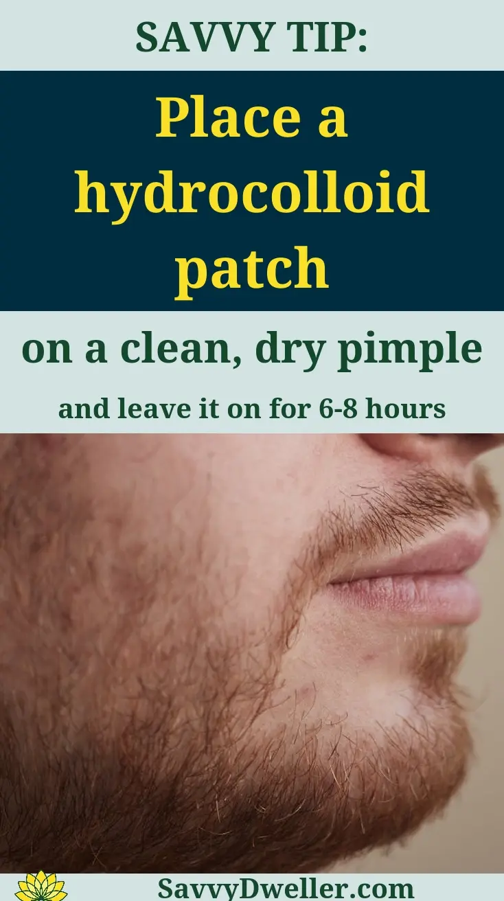 Hydrocolloid patch applied to a clean, dry pimple for fast acne relief.