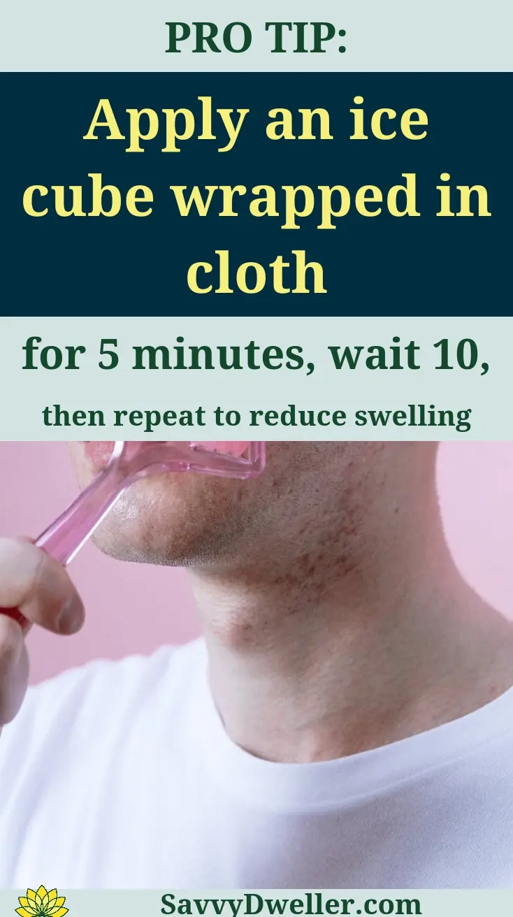 Applying an ice cube wrapped in cloth for pimple treatment