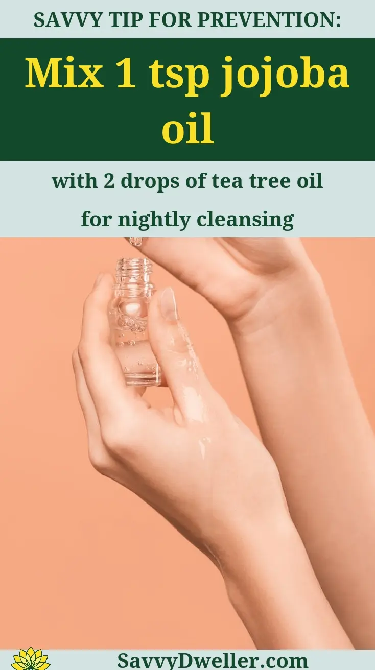 Hands holding a bottle of jojoba oil and tea tree oil for home treatment of whiteheads.