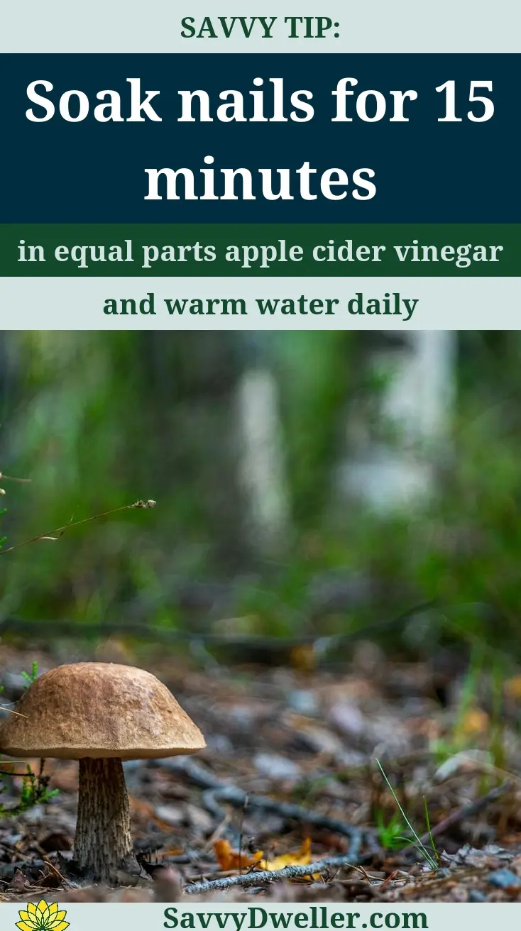 A tip for treating nail fungus with apple cider vinegar and warm water.