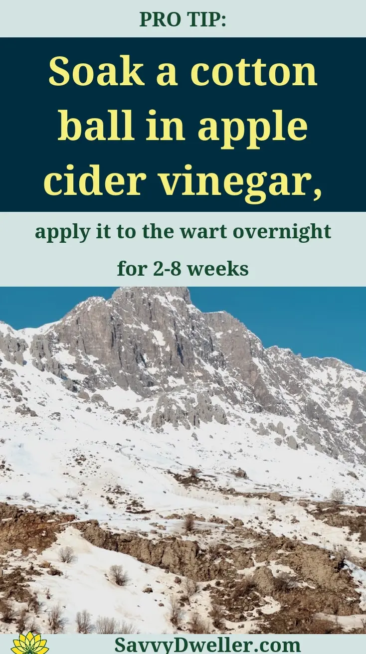 Cotton ball soaked in apple cider vinegar for wart removal treatment