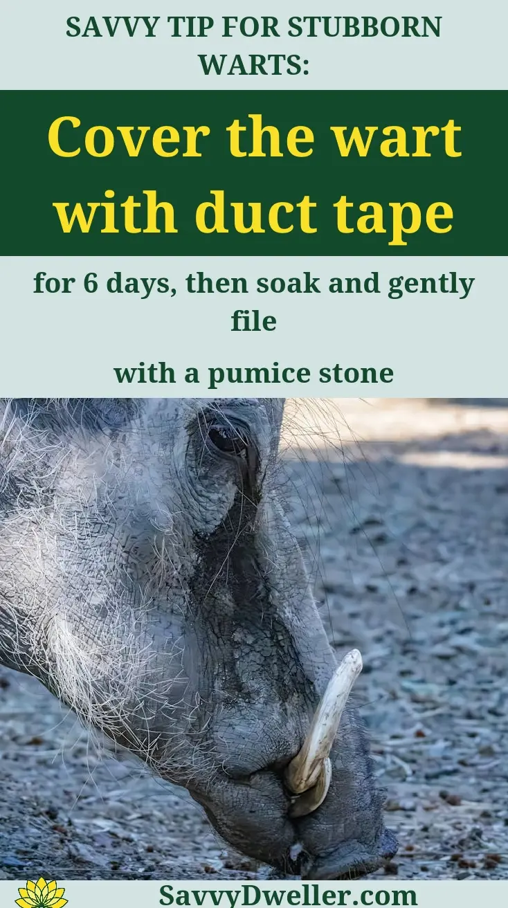 Natural remedy for removing warts at home using duct tape technique