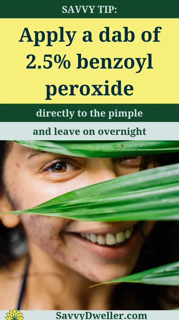 Woman with a smile applying benzoyl peroxide to treat a pimple overnight